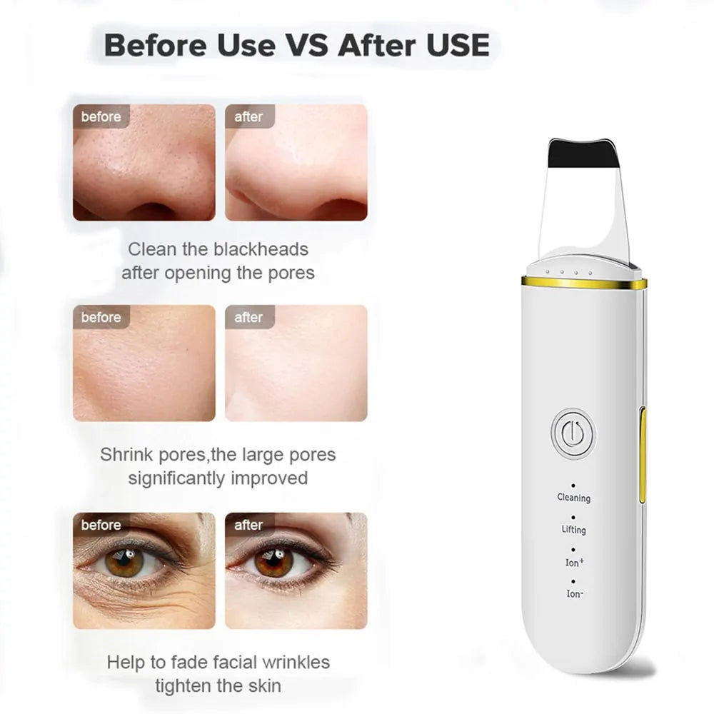 Beautsonic Skin Scrubber